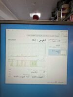 ⁦Lenovo ideapad 330s USED⁩ - الصورة ⁦4⁩